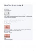 Identifying Dysrhythmias <3 Exam Questions And Answers 