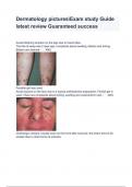 Dermatology picturesExam study Guide latest review Guaranteed success 