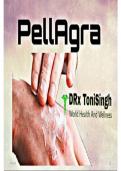 Pellagra