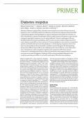 Diabetes insipidus