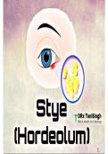 Stye hordeolum