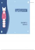 Hypothyroidism - pediatrics 