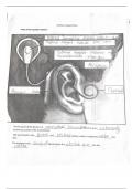 Cochlear implants notes