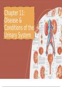 Diseases & Conditions of the Urinary System