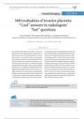 MRI evaluation of invasive placenta:  “Cool” answers to radiologists’  “hot” questions