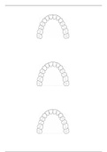 Prothese: blanco afbeelding voor oefeningen framedesign