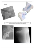 Medische beeldvorming herhaling osteologie