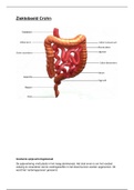 Ziekte van Crohn uitgewerkt