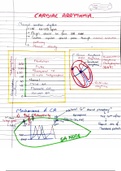 CARDIAC ARRYTHMIA (DR. NAJEEB)