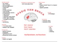 schematische voorstelling afasie