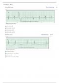 Relias Dysrhythmia Basic Test 2025/2026 Answers Dysrhythmia – Basic A ( A+ GRADED 100% VERIFIED)