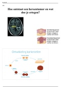 Verslag over en hersentumor