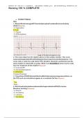 RELIAS DYSRHYTHMIA BASIC TESTBANK ANSWERS 2024-2025 DYSRHYTHMIA –BASIC A&B (A+ GRADED), Exams of Nursing - benign rhythm