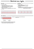 Cardiac Arrhythmias and their ECG interpretation (Guyton & Hall)