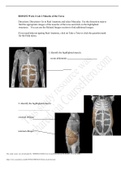 Exam (elaborations) BIOS 252 Week 2 Lab: Muscle Physiology 