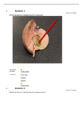 ANATOMY AN 2347L LAB Module 6 Quiz Answers