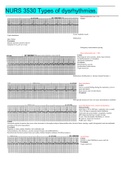 NURS 3530 Types of dysrhythmias.