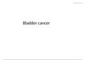 Bladder cancer