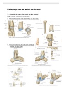 Pathologie-van-de-enkel-en-voet