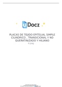 Análisis de placas histológicas donde podemos apreciar las estructuras y células presentes en el tejido epitelial cilíndrico transicional, no queratinizado y hialino