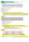 NUR 299 MEDSURG FINAL EXAM- Molloy College