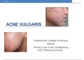 NR 602 PowerPoint Presentation Acne Vulgaris.