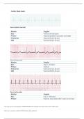 Texas Wesleyan University NURSING 8 Cardiac Study guide.