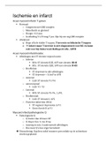 samenvatting/schema cardiovasculaire ziekten en ECG