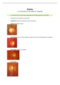 Klopto 3: Visus verlies ONH en imaging  van Louise van Doorn, Jaar 2, Blok B
