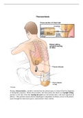 NR NSGAUworld Nclex Well revised Notes.