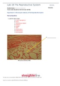 Exam (elaborations) BIO 202L Lab 18 Worksheet- The Reproductive System Lab 18 The Reproductive System BIO202L Student Name: Click here to enter text. Access Code (located on the lid of your lab kit): Experiment 1: Microscopic Anatomy of the Reproductive S