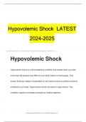 Hypovolemic Shock  LATEST 2024-2025