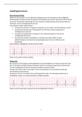 Samenvatting ritme- en geleidingsstoornissen