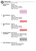 Foundations of EKG Interpretation - Prophecy Health Complete/ Prophecy EKG Terms And Explanations Altogether