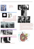 RADIOLOGY -Imaging of the Pharynx, Esophagus, Stomach & Duodenum