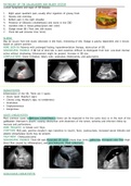 PATHOLOGY OF THE GALLBLADDER - Ultrasound 