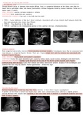 PATHOLOGY OF THE BILIARY SYSTEM - Ultrasound 