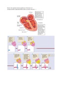 Arrhythmias - Clinical Medicine 