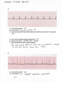 EKG QUIZ