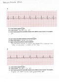 EKG Quiz