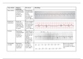 Tabel ECG'S van CiRe