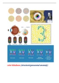 CHROMOSOME ABNORMALITIES ( DALTONISM )