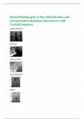 Dental Radiography X-Ray Identification and Interpretation Questions and Answers with Verified Solutions