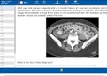 Oncology-Anatomy-Embryology-Physiology-Practice-Test-With-Answer-And-Explanation.pdf