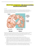 NR-507 Week 7 Assignment: CNS: Sensory and Motor Disorders (E-dapt Content) | aLREADY GRADED A