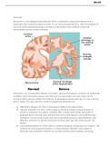 NR-507 Week 7 Assignment: CNS: Sensory and Motor Disorders (E-dapt Content) | aLREADY GRADED A