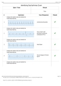 CH.Identifying Dysrhythmias Exam A GRADED