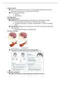 Class notes RNSG 1341 - Stroke