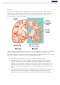 NR-507 Week 7 Assignment: CNS: Sensory and Motor Disorders (E-dapt Content) | aLREADY GRADED A Dementia is not a stand-alone disease, but rather, a group of symptoms caused by an underlying condition. Most dementias worsen over time and are irreversible, 