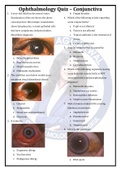 Ophtha Quiz – Conjunctiva